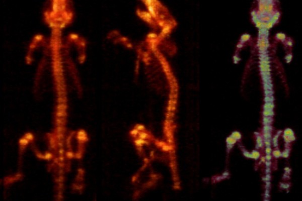 The first animal images we obtained using our newly-developed PET scanner (Xtrim)